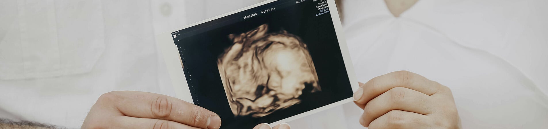 A family without insurance watching their baby's ultrasound.